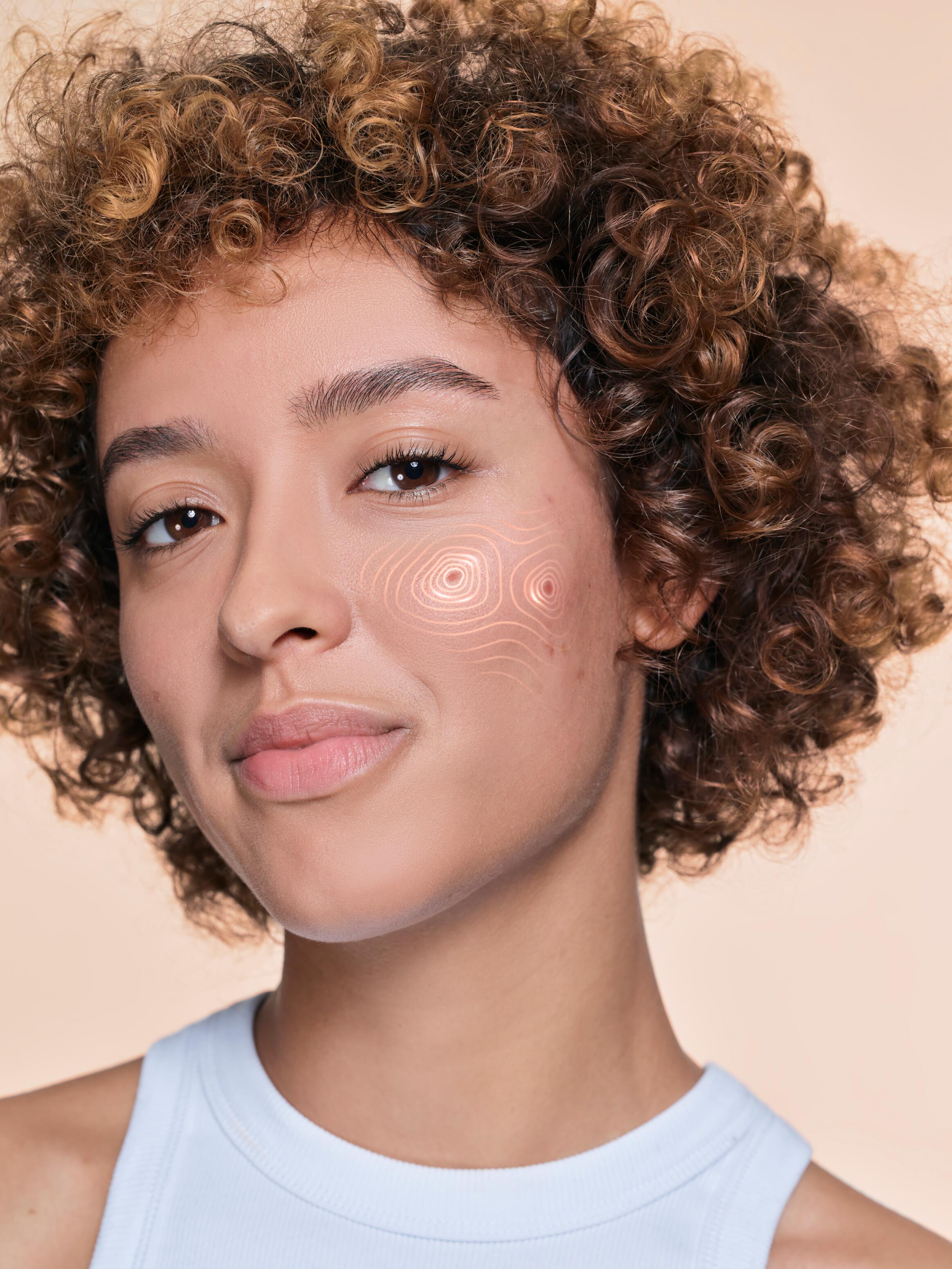 Acne treatment for adults